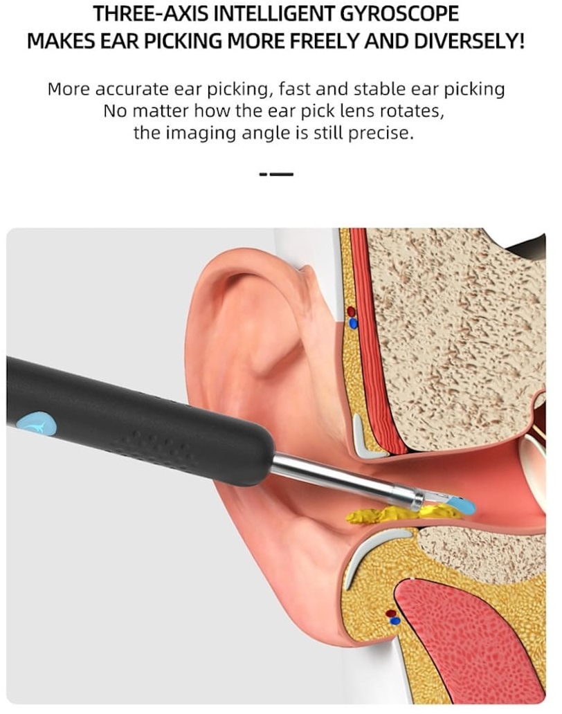 odstraňovač ušného mazu s kamerou cistenie usi